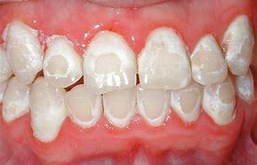 دندانپزشکی تخصصی ارتودنسی تهران, کلینیک تخصصی ارتودنسی, بهترین مرکز ارتودنسی در تهران, فوق تخصص ارتودنسی در تهران, قیمت ارتودنسی دندان در تهران, قیمت کاشت دندان مصنوعی,قیمت دندان مصنوعی آلمانی